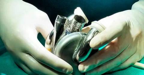 Aussie man becomes first to leave hospital with titanium heart